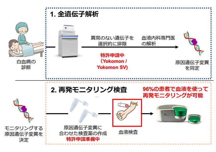白血病の再発を早期に発見するモニタリング検査
