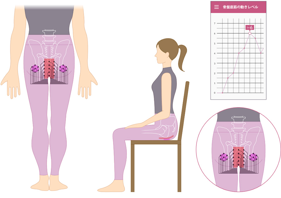 骨盤底筋トレーニングを効果的にできるデバイス開発