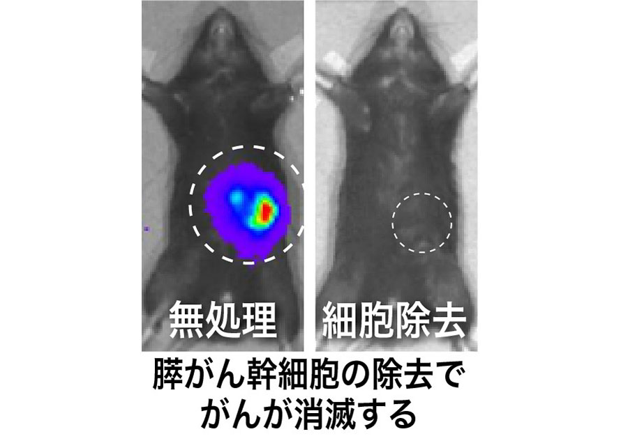 膵がん幹細胞の光免疫療法による撲滅法の開発
