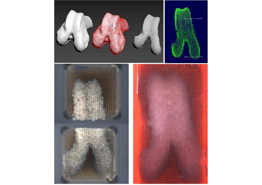 iPS細胞由来の細胞製人工膝関節の研究開発