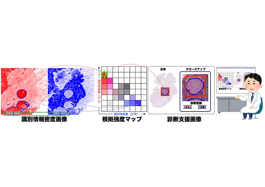 判断根拠を提示できる病理画像診断人工知能技術