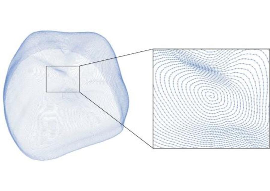 純国産！歯科用CAD/CAM冠システムの開発