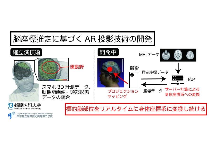 頭皮越しに脳を可視化する医療基盤技術の開発