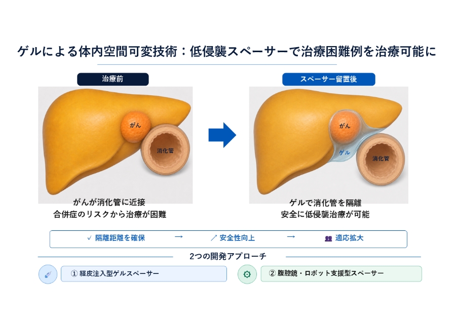 吸収性ゲルスペーサーを用いた体内空間可変技術