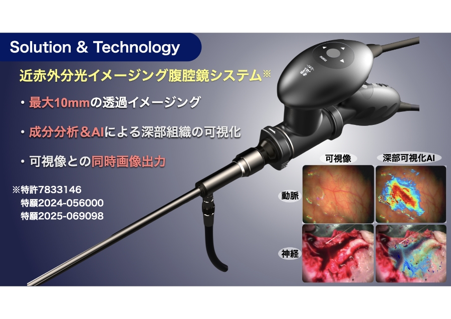 見えない深部を可視化する次世代内視鏡システム